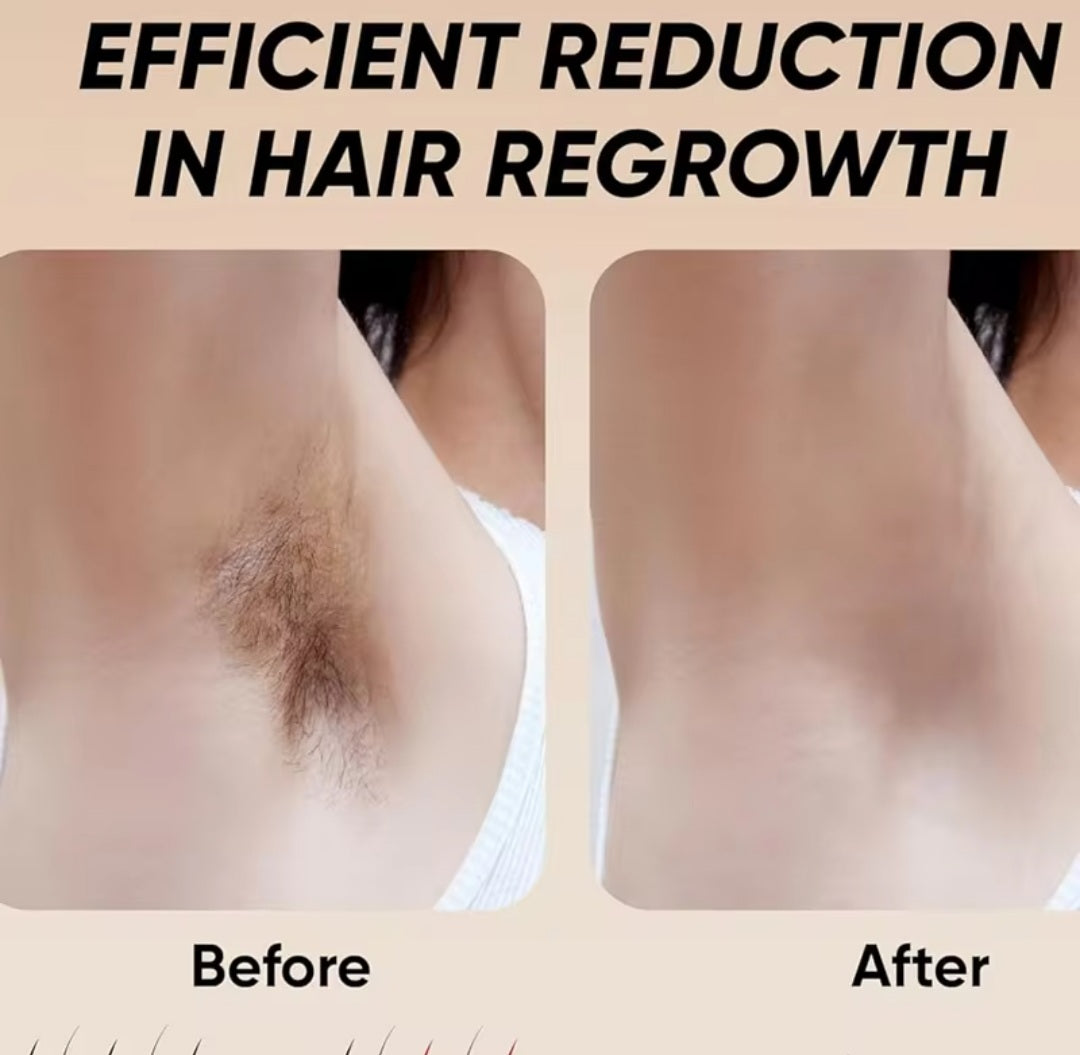 Hair-removal