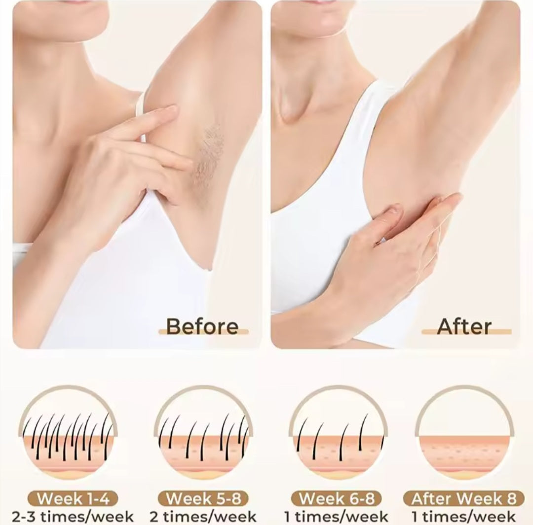 Hair-removal