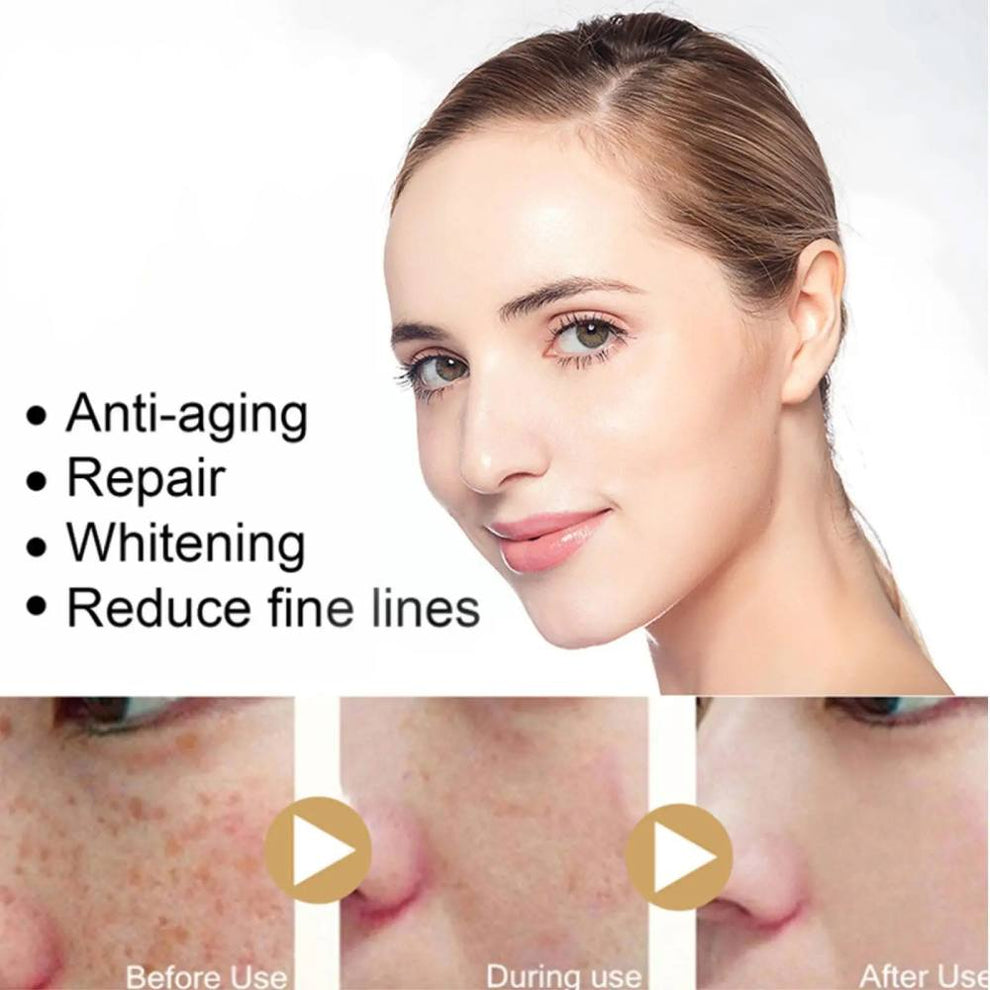 Whitening Freckle Serum- Turmeric Serum for Age and Dark Spots